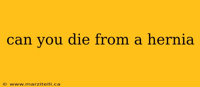 can you die from a hernia