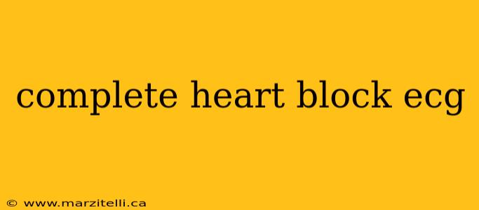 complete heart block ecg