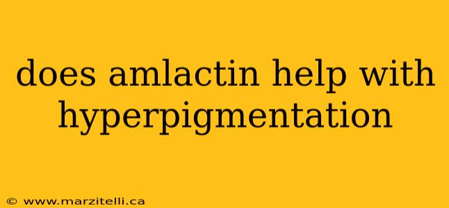does amlactin help with hyperpigmentation