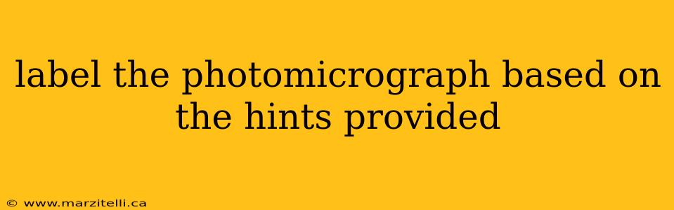 label the photomicrograph based on the hints provided