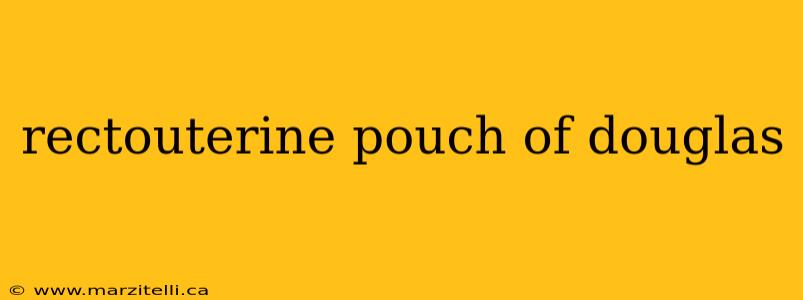 rectouterine pouch of douglas