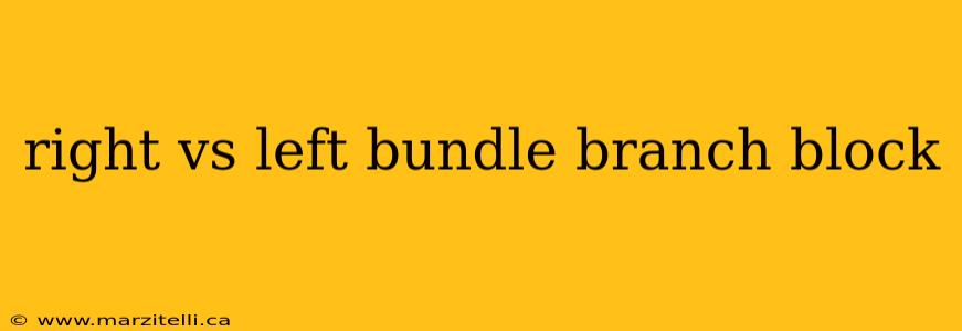 right vs left bundle branch block