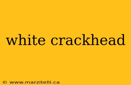 white crackhead